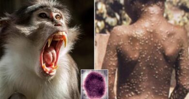 Viruela del mono: quiénes corren más riesgo de contagiarse